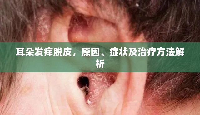 耳朵发痒脱皮，原因、症状及治疗方法解析