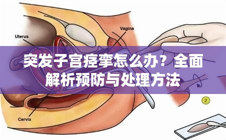 突发子宫痉挛怎么办？全面解析预防与处理方法