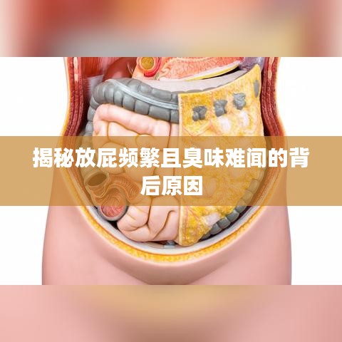 揭秘放屁频繁且臭味难闻的背后原因