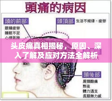 头皮痛真相揭秘，原因、深入了解及应对方法全解析