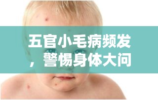 五官小毛病频发，警惕身体大问题！